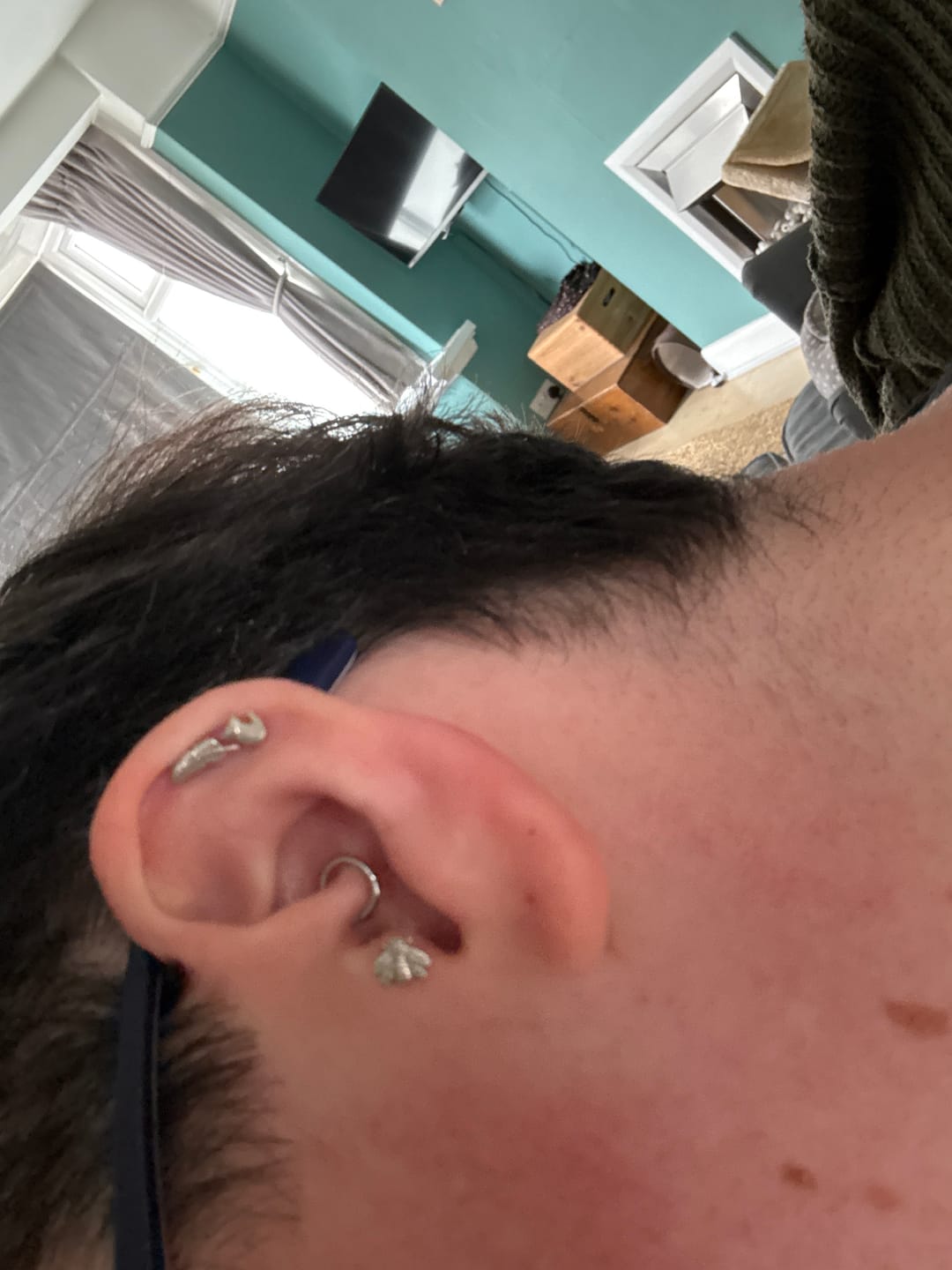 Customer photo review of Junipurr Titanium Flatback Labret Threadless