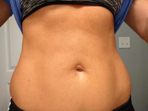 Customer photo review of Nuvex™️ Anti Cellulite Massage Oil