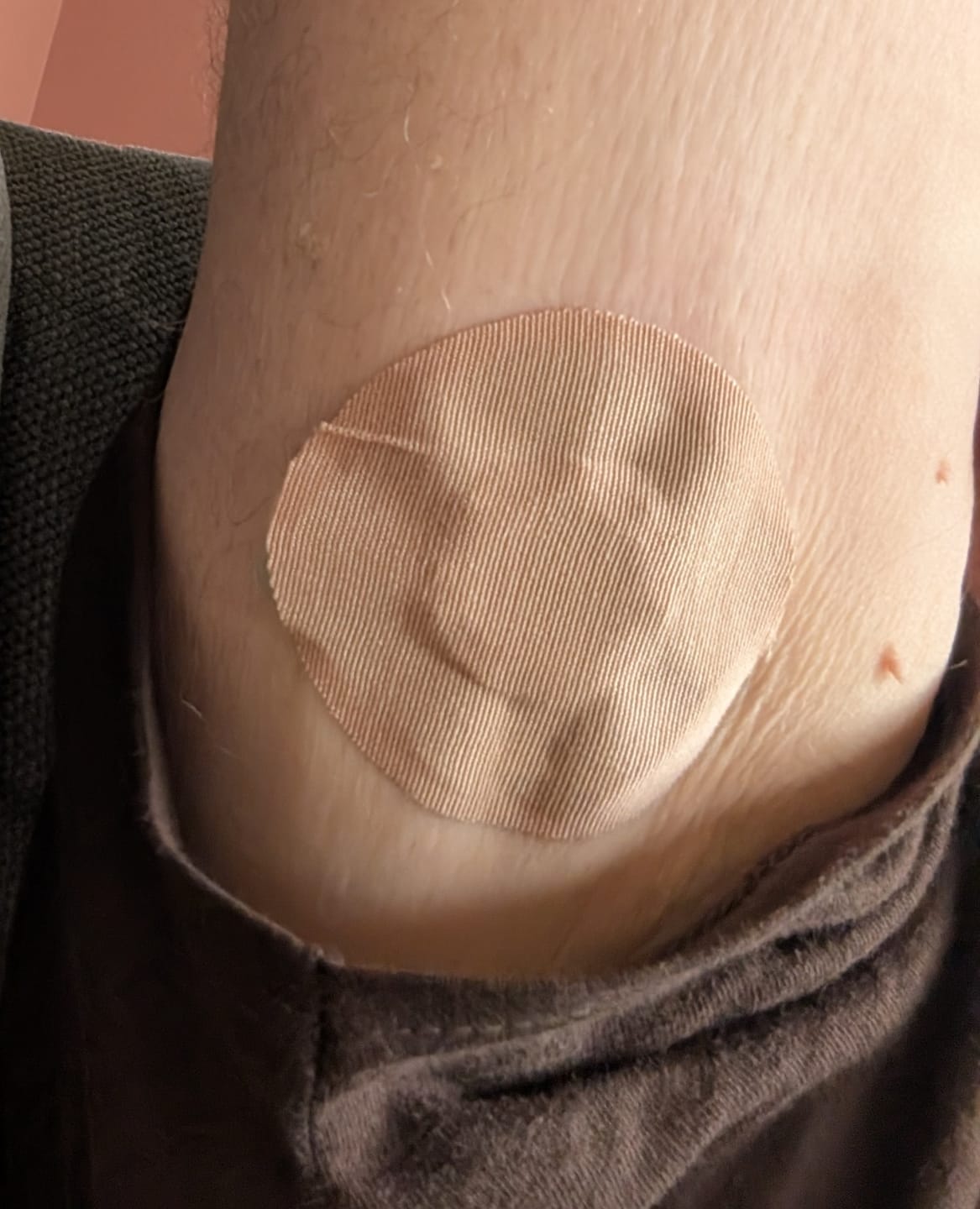 Customer photo review of Skin Grip Original - Dexcom G7 & Stelo Adhesive Patches
