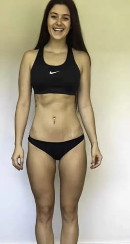 Customer photo review of Nuvex™️ Anti Cellulite Massage Oil