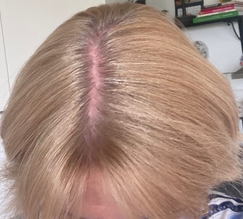 Customer photo review of Sunkissed Refill 1-pack