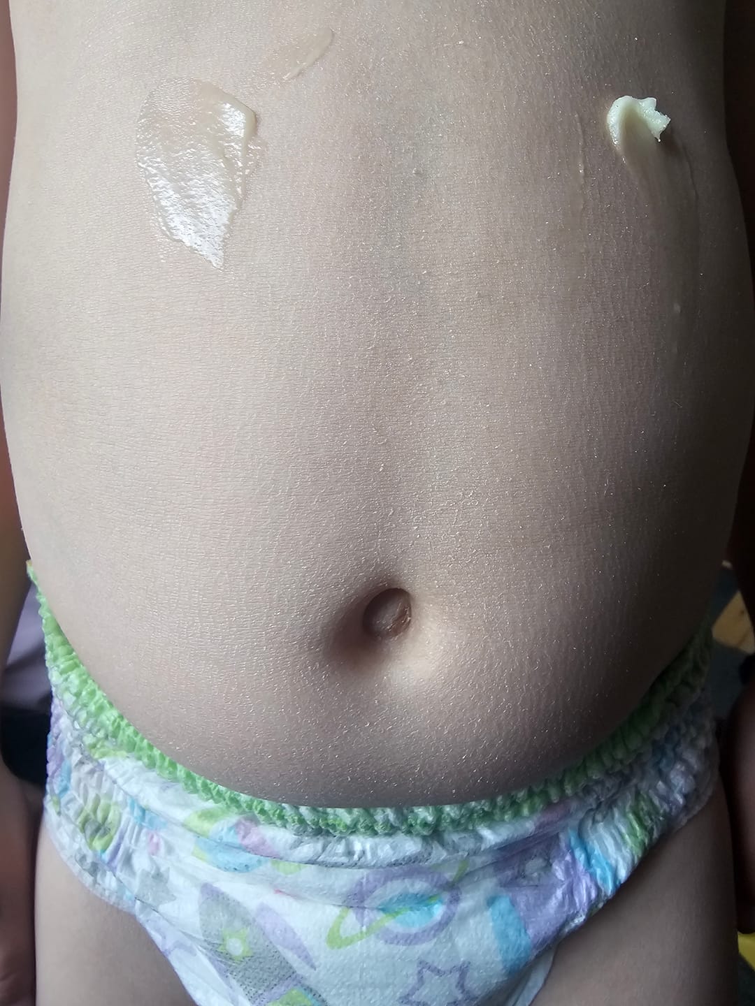 Customer photo review of Grass-Fed Tallow Soap | Moisturising Cleansing Bar