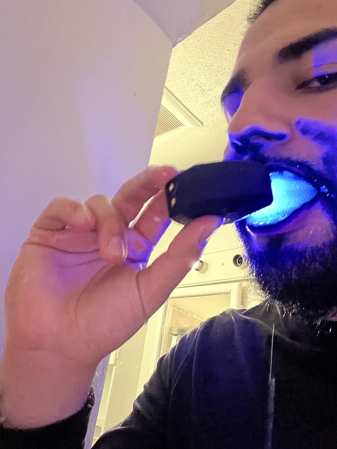 Customer photo review of Sonic Brush® V5