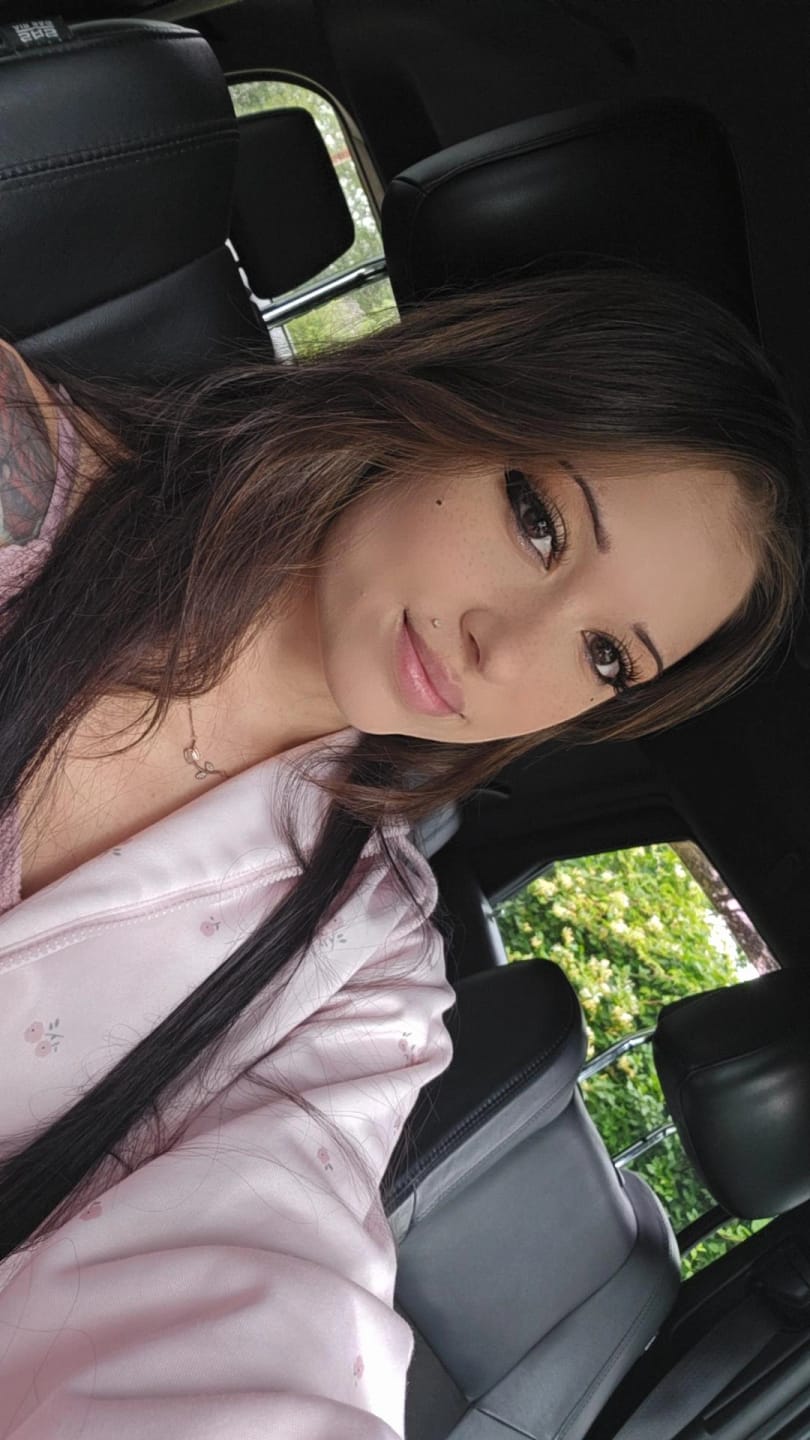 Customer photo review of Eyeling Custom Lens (1 month)