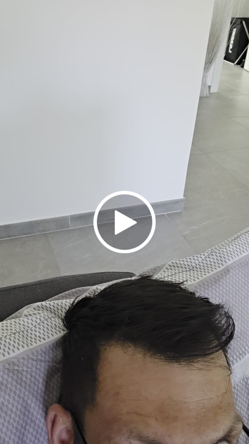 Customer video review of Fibre copri Calvizie da 12gr  | Castano Scuro | 30 Giorni di applicazioni