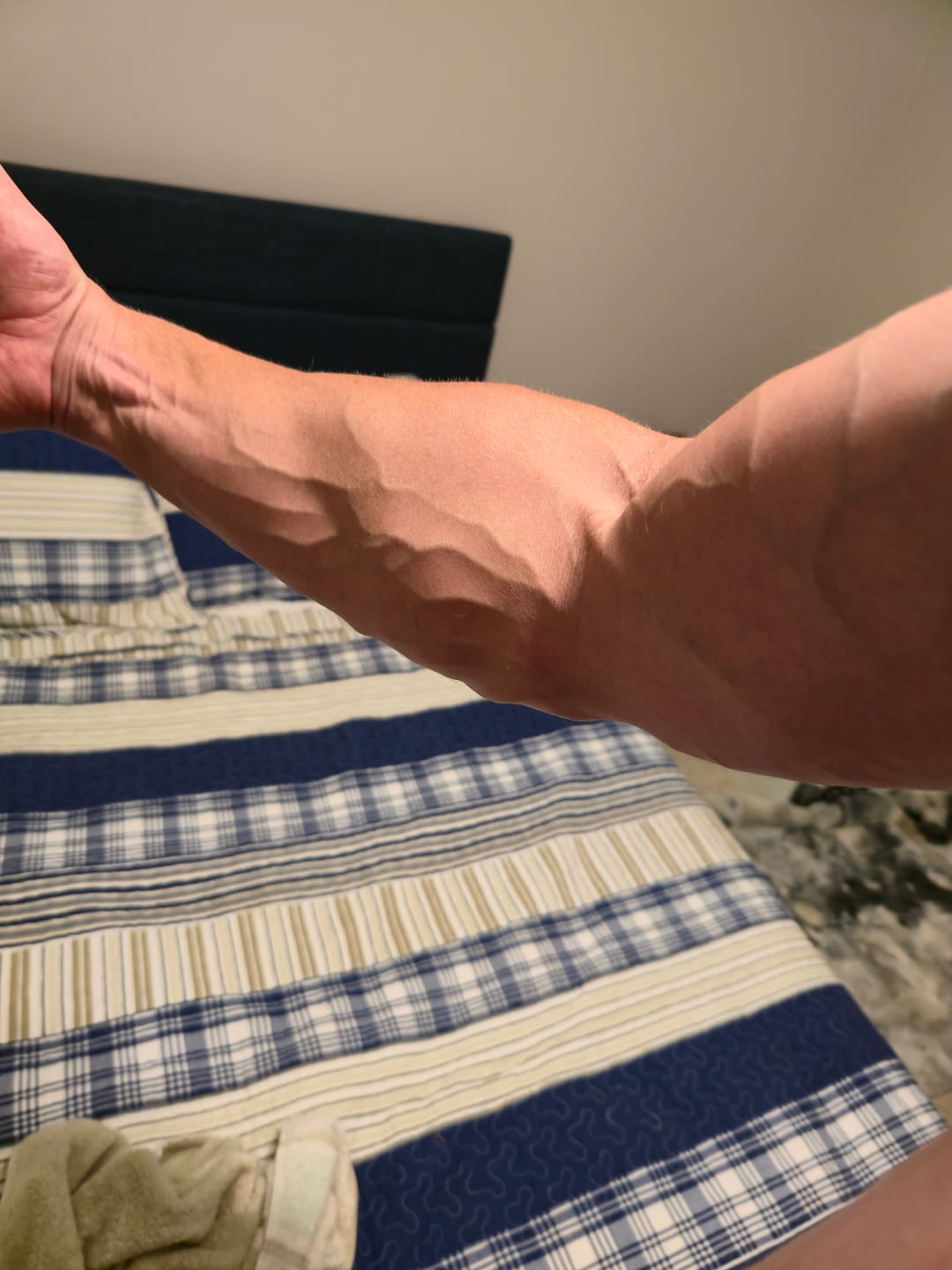 Customer photo review of 1-Androl Stack
