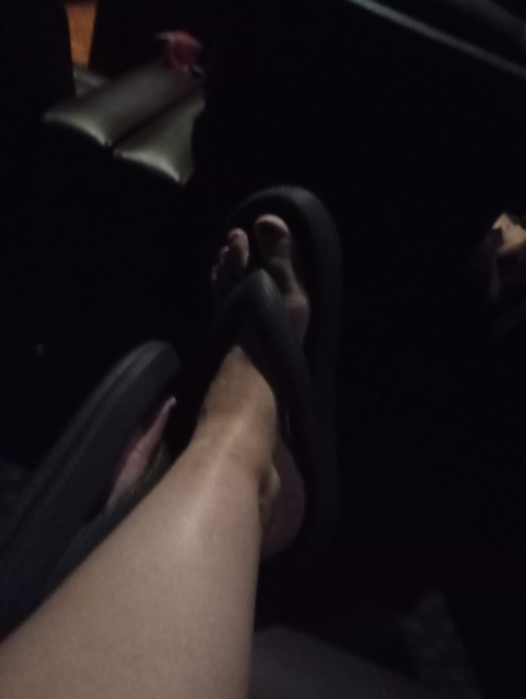Customer photo review of Orthopedic Flip Flops - Cloud Slides