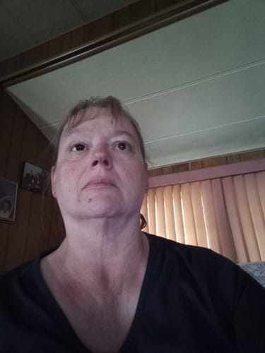 Customer photo review of Bramble Brown Prosthetic Lenses