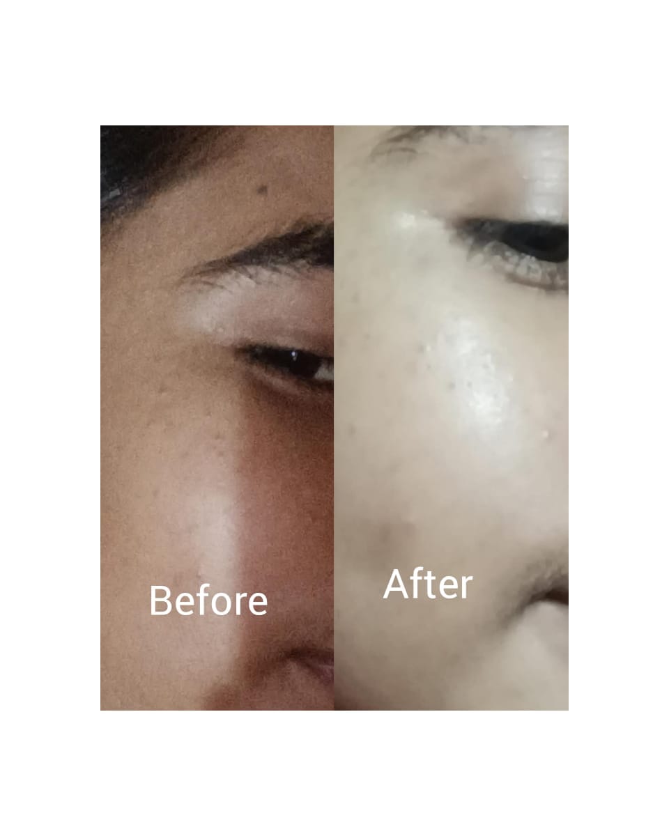 Customer photo review of Brightening Cream