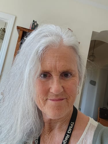 Customer photo review of Glov Hair Regrowth System