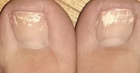 Customer photo review of Anti-Fungal Serum