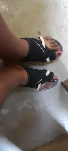 Customer photo review of HexoComfy™ Orthopedic Women's Slippers