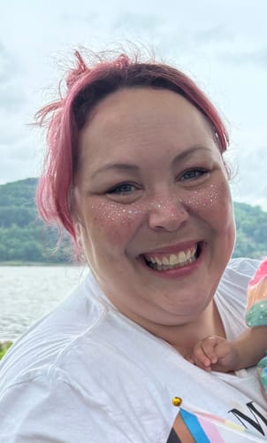 Customer photo review of Sprinkles Glitter Freckle Makeup Patches