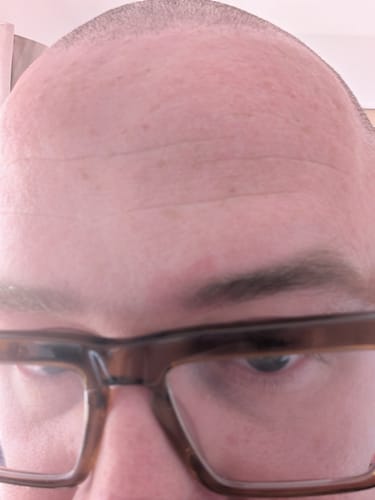 Customer photo review of Seb Natural Calming Serum