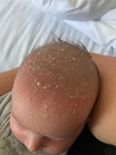 Customer photo review of Happy Scalp Cream™