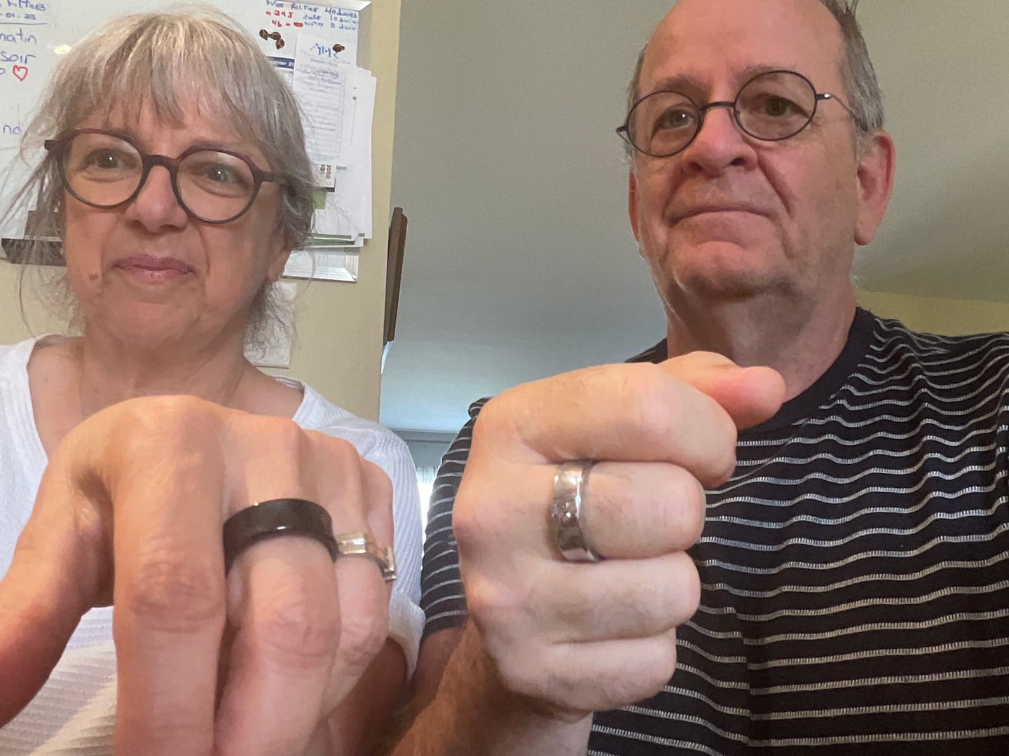 Customer photo review of Pulserive Smart Ring, Sleep Tracker, Activity & Fitness Tracker, Blood Pressure& Oxygen Tracker