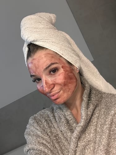 Customer photo review of Pore Perfection