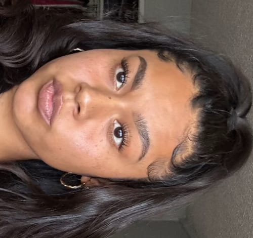 Customer photo review of Hypochlorous Acid Spray for Skin & Face | Cleansing Topical Spray