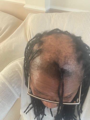 Customer photo review of Chebe Hair Growth Oil