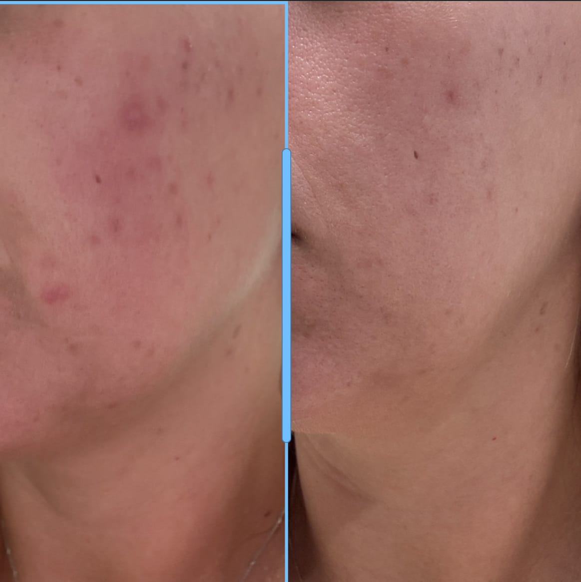 Customer photo review of dr.NC CONCENTRATED ILLUMINATOR 10% Vit B3, 10% Vit C - 30ml