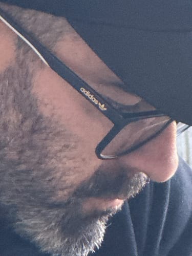 Customer photo review of ULTIMATE Anti-Ageing Skincare Bundle