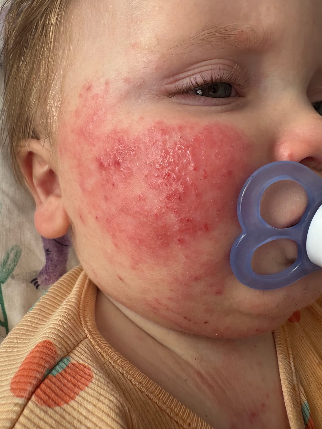 Customer photo review of Bioskin Junior Duo Pack