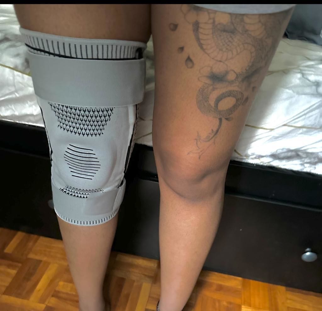 Customer photo review of Ultra Knee Elite™ 2.0