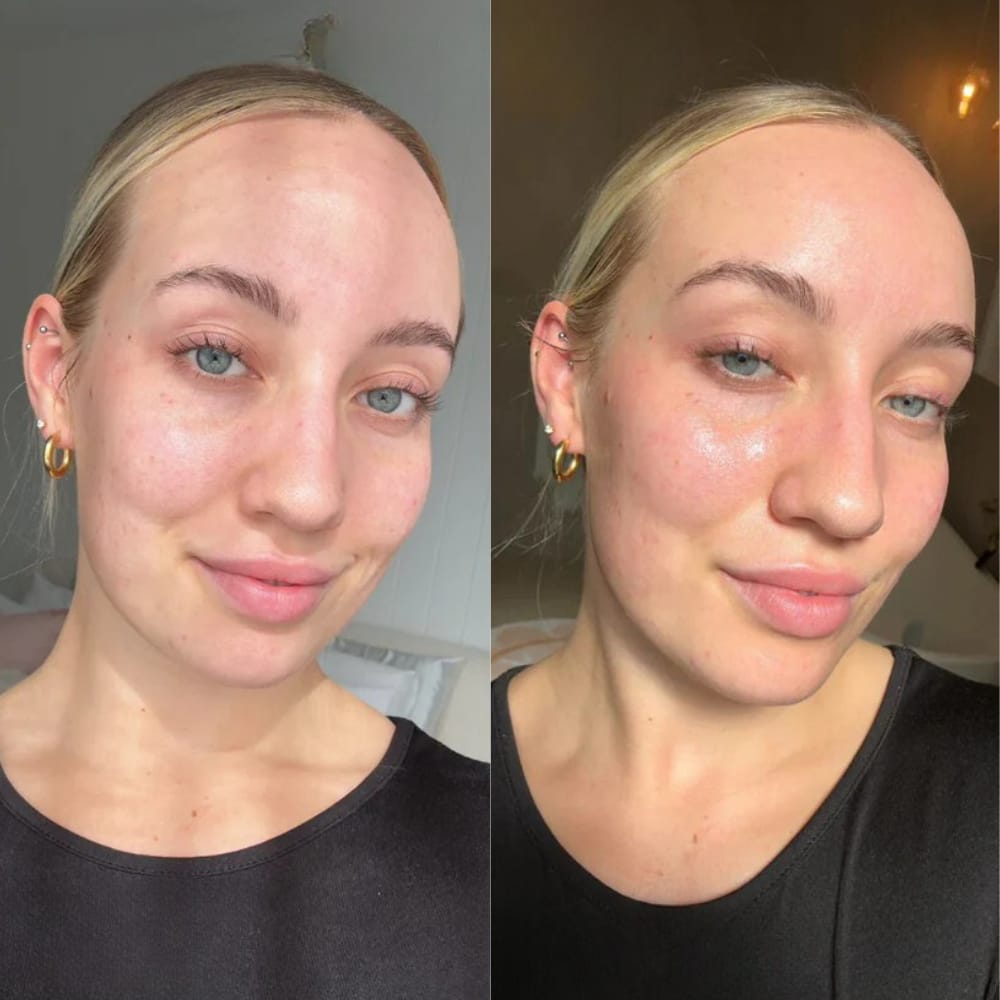 Customer photo review of Bio-Collagen Real Deep Mask