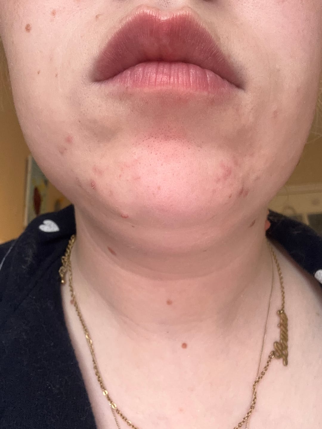 Customer photo review of Antiac Activ Liquid Spray
