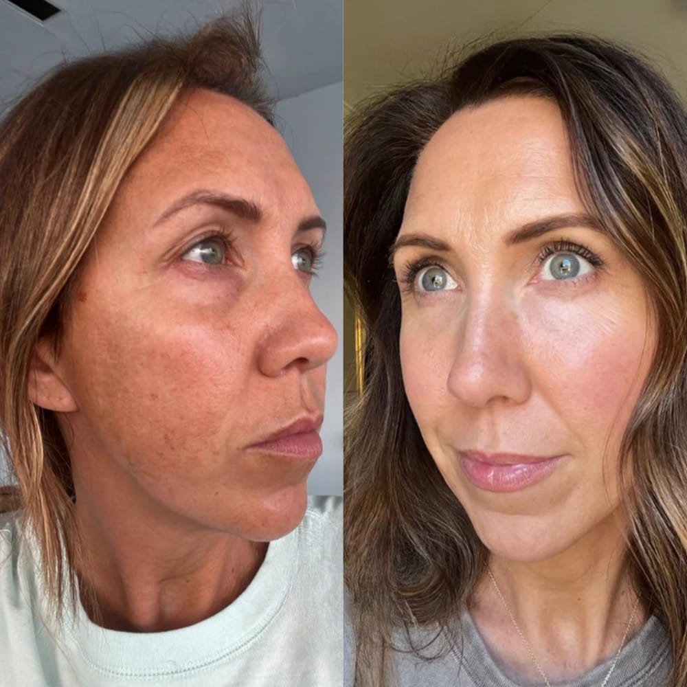 Customer photo review of Bio-Collagen Real Deep Mask