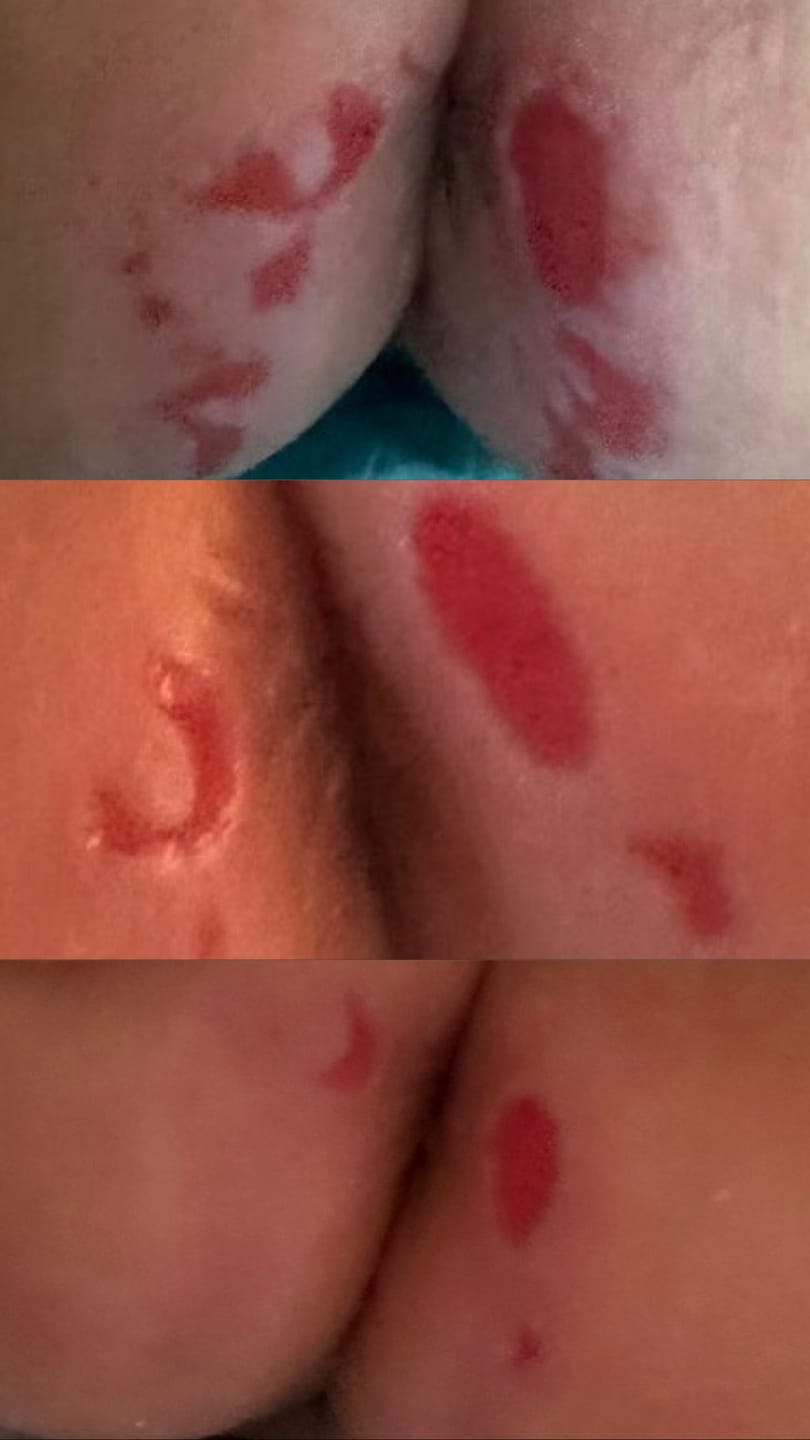 Customer photo review of Baby Bum Balm