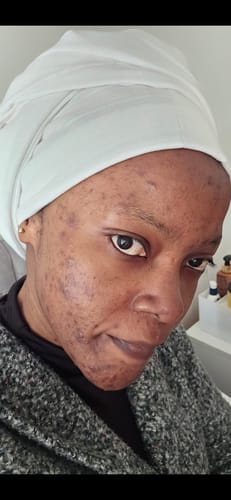 Customer photo review of Turmeric Glow Soap