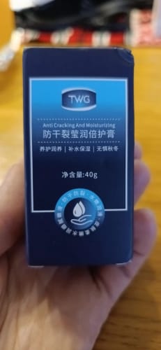 Customer photo review of SoleRenew™ Cracked Heel Repair Balm