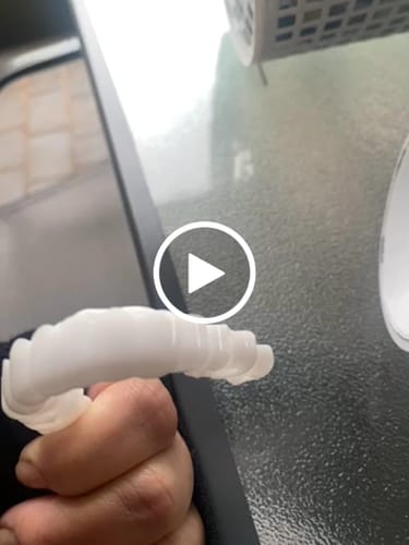 Customer video review of Official SnapOn Veneers