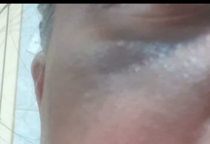 Customer photo review of Super Glaze