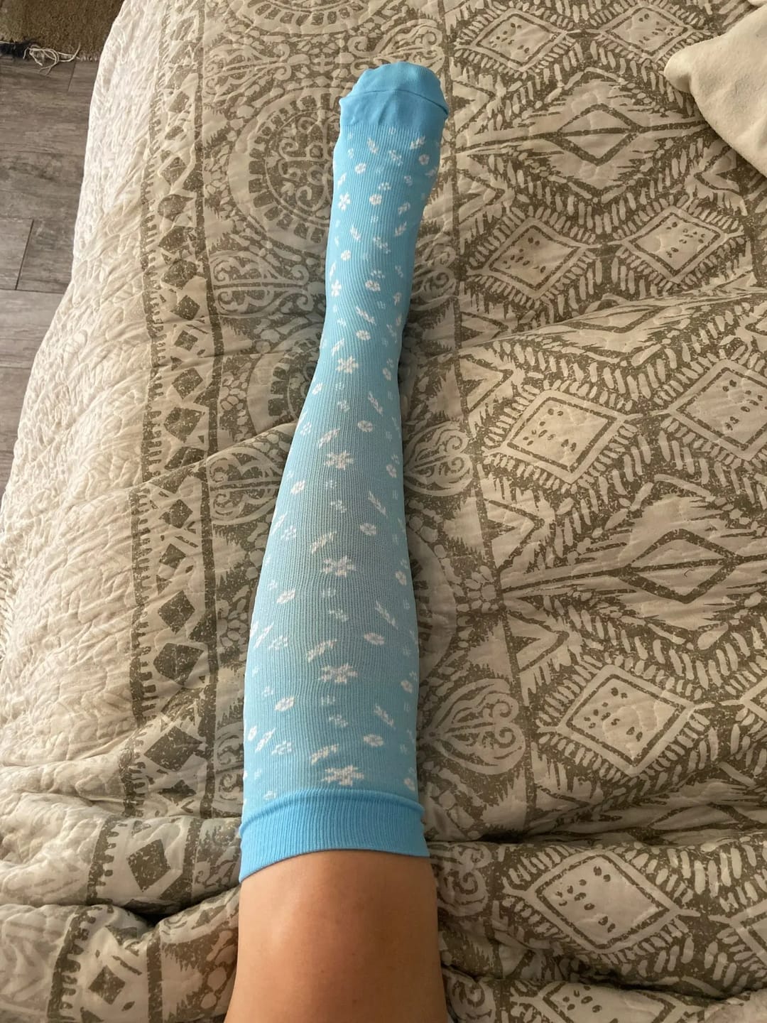 Customer photo review of Orthopädische Kompressionsstrümpfe Summer Edition