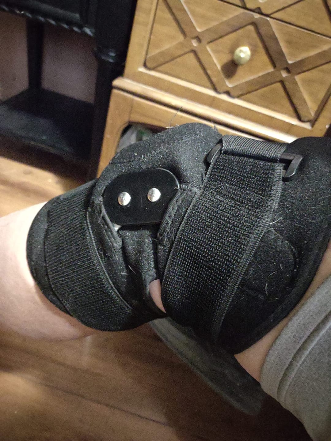Customer photo review of WeRelieve™ Orthopedic Knee Pad