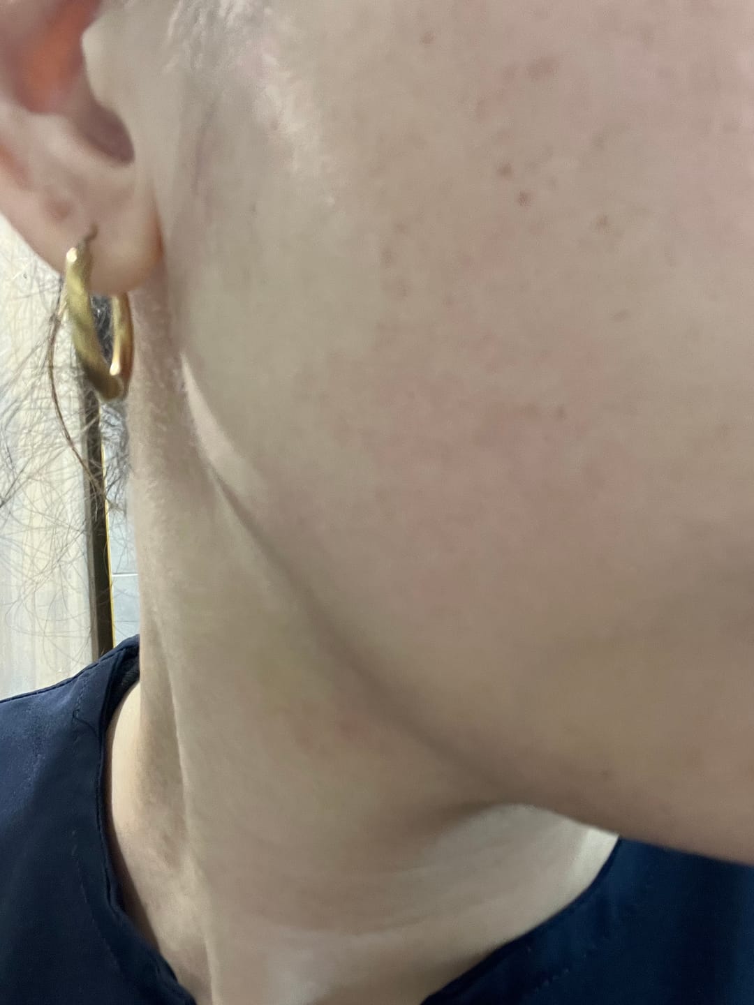 Customer photo review of ⭐ Full Set