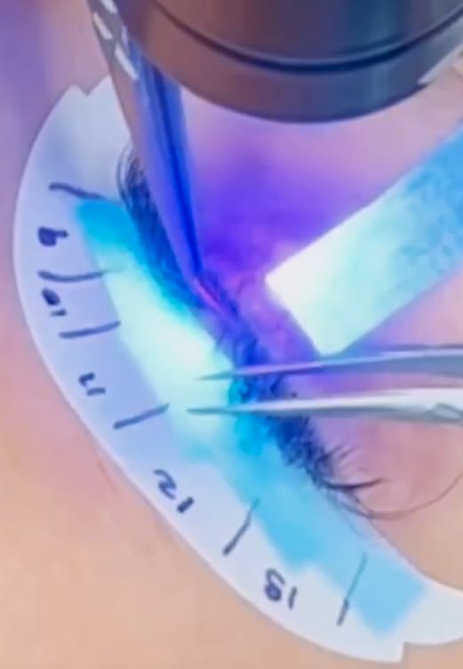 Customer photo review of UV Lamp