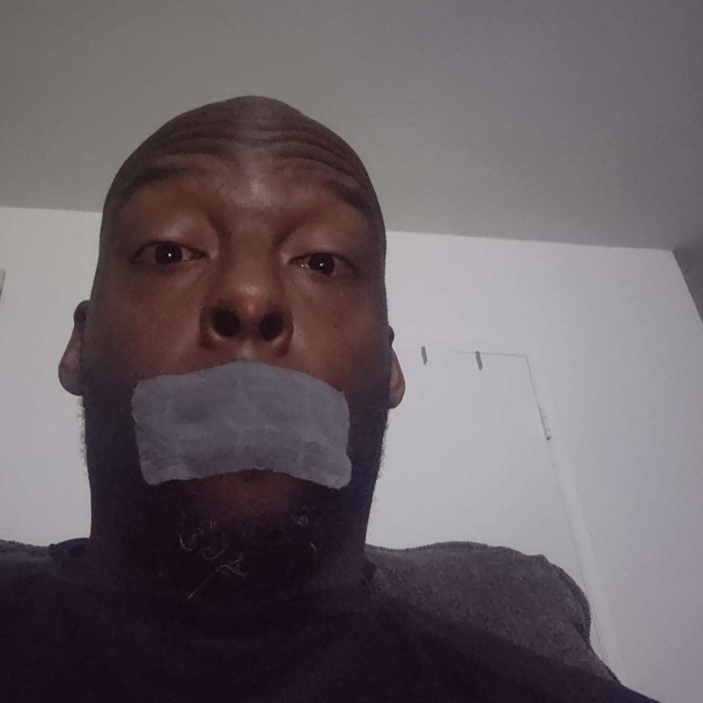 Customer photo review of ZzzTape - Mouth Tape