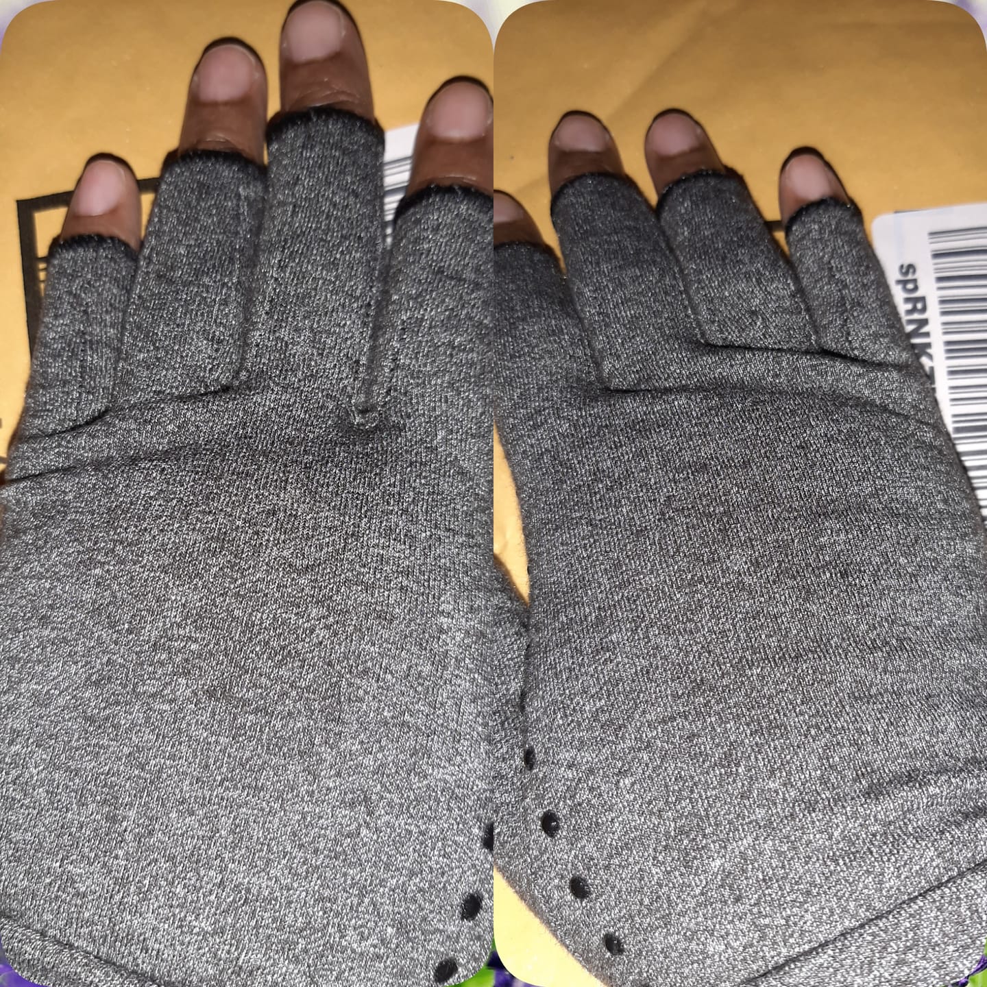 Customer photo review of WeRelieve™️ - Arthritis Compression Gloves