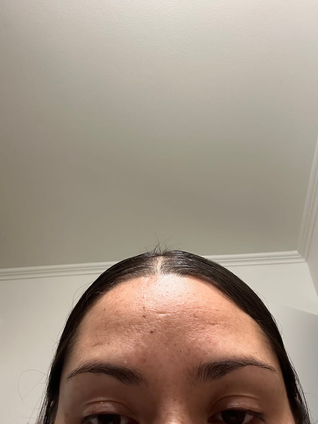 Customer photo review of Pack Anticaída de Cabello para 1 Mes