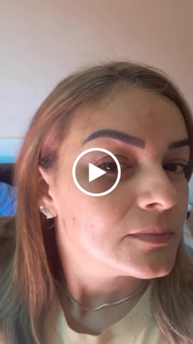 Customer video review of Happy Hair 3 Potes + 3 Potes Grátis + 1 Pote de Melatonina + 1 Pote de Colágeno (Total 8 Potes)