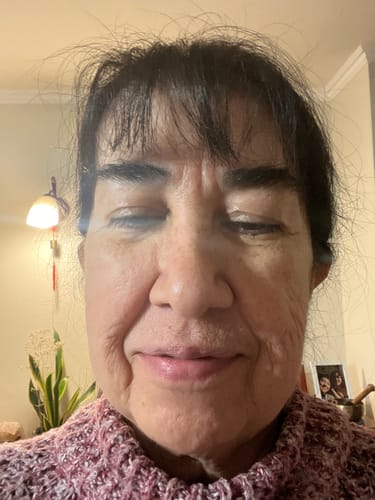 Customer photo review of Serum Antimanchas 30ml