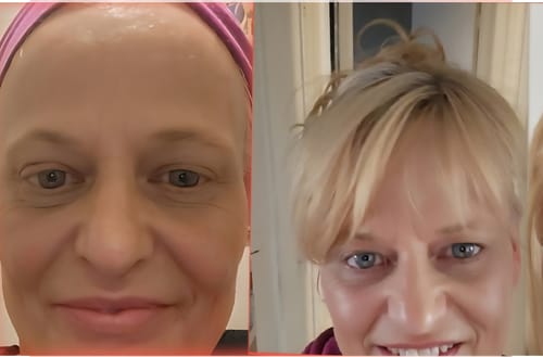 Customer photo review of F-Balm - Premium Anti-aging Tallow Balm - 2 oz.