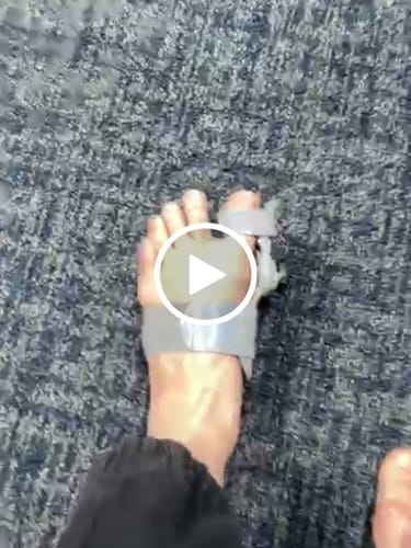 Customer video review of Treatmedy™ Bunion Fix - Natural At-Home Bunion Relief
