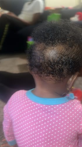 Customer photo review of Hair Transformation Bundle- Moisturizes, Detangles, Drastically softens and Grows! 3 Sizes