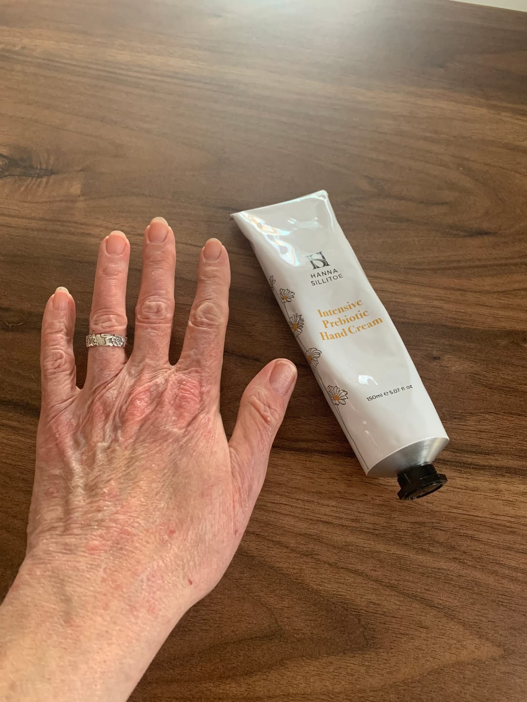 Customer photo review of Prebiotic Hand Cream