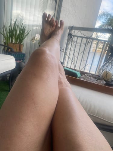 Customer photo review of Besque™ Magic Body Oil - 100ml