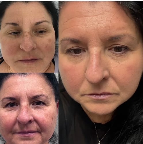 Customer photo review of ZO Firming Serum Accelerated